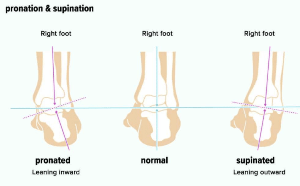 Famous runners hotsell with flat feet